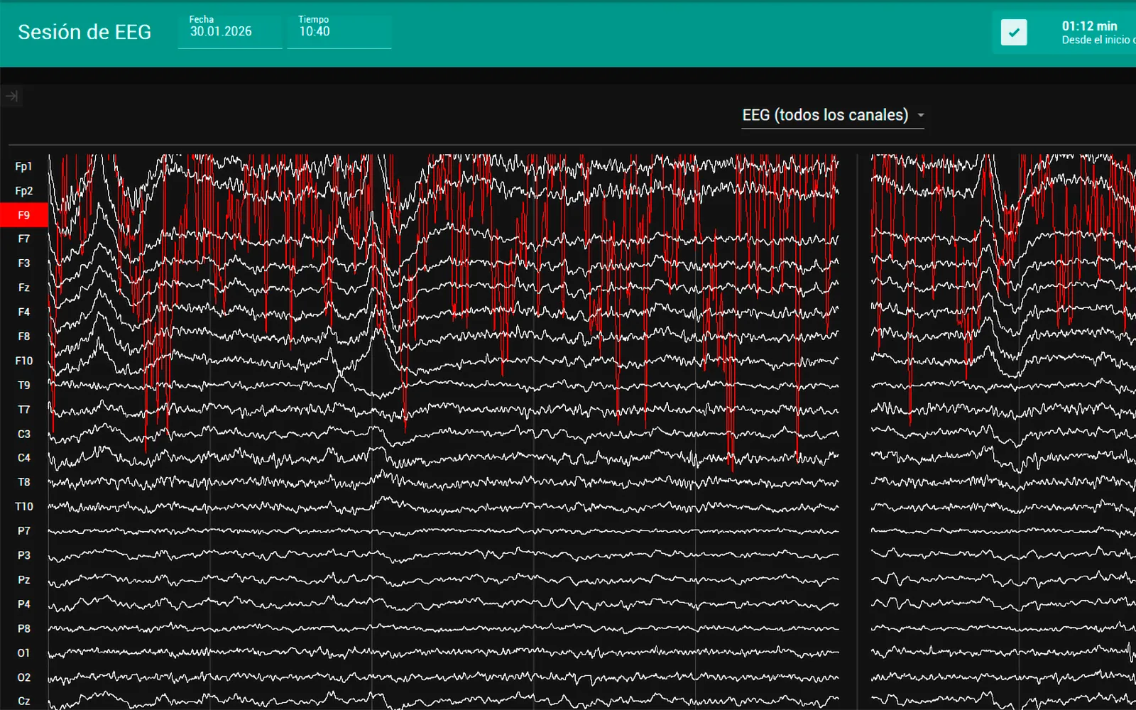 Foto: puesto de trabajo con registros de qEEG en el Instituto Andaluz de Salud Cerebral