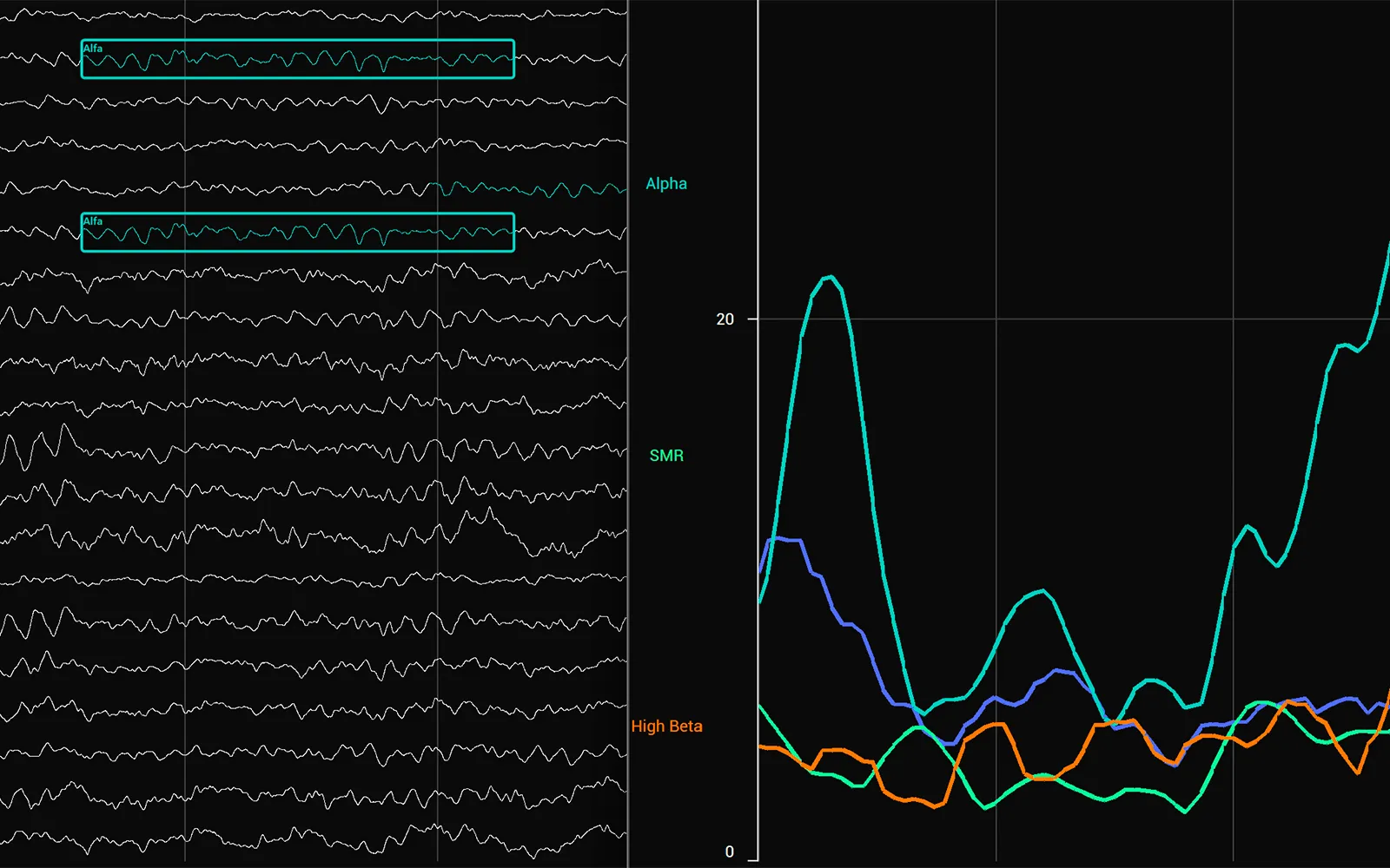 Foto: puesto de trabajo con registros de qEEG en el Instituto Andaluz de Salud Cerebral